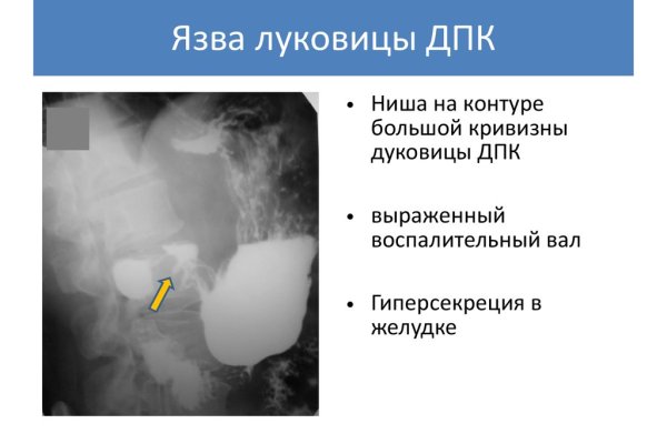 Нарко маркетплейс
